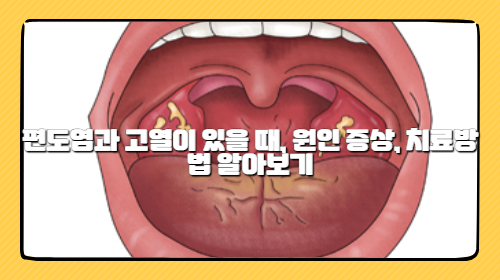 편도염과 고열이 있을 때, 원인 증상, 치료방법 알아보기