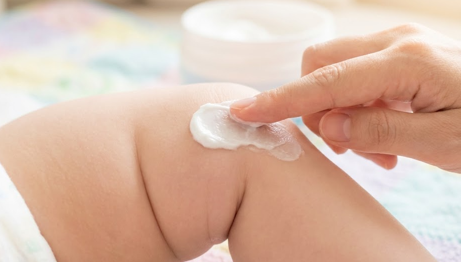 습진·지루성 등 다른 피부질환과 구분 포인트