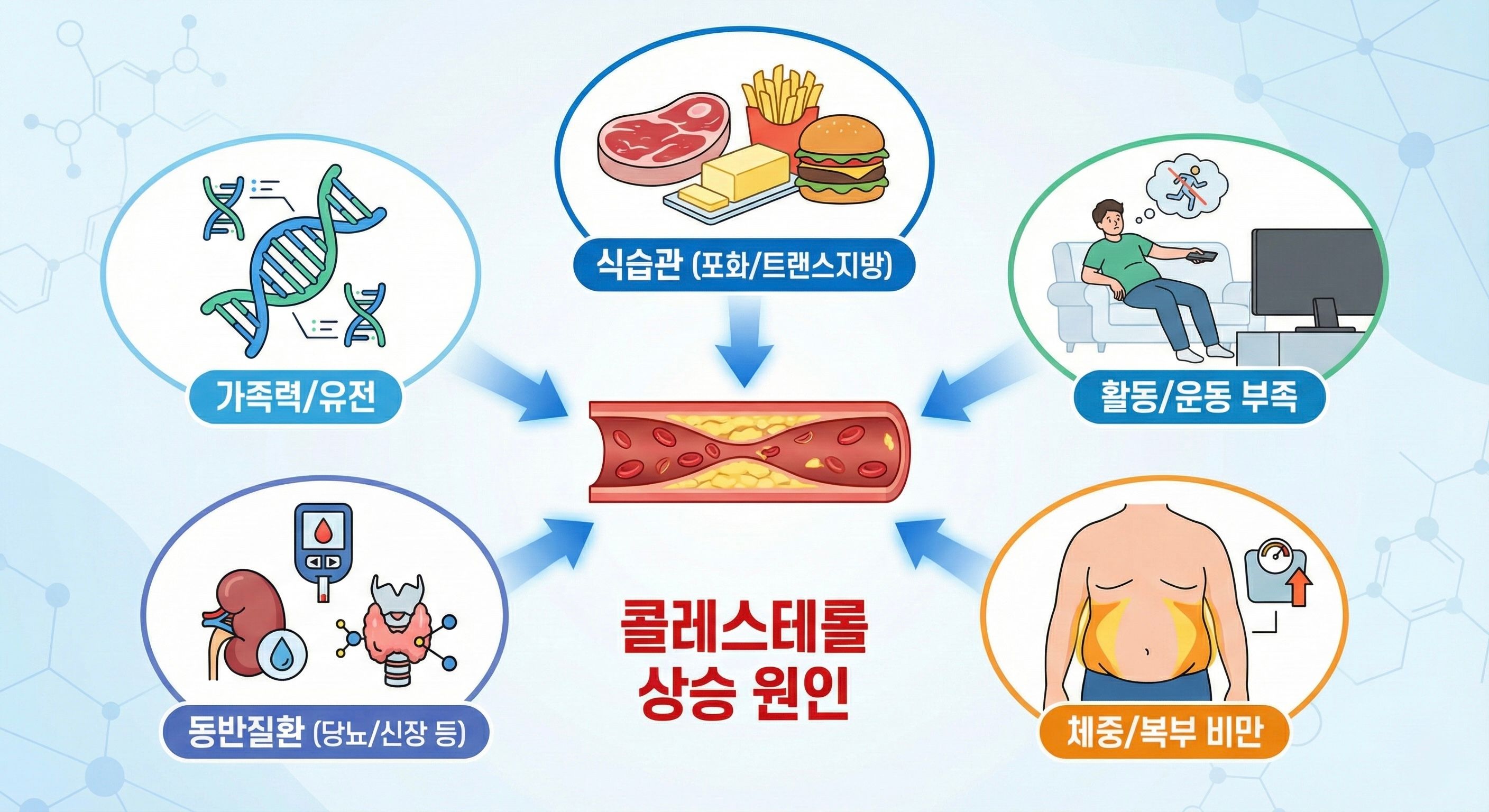 콜레스테롤이 높아지는 주요 원인